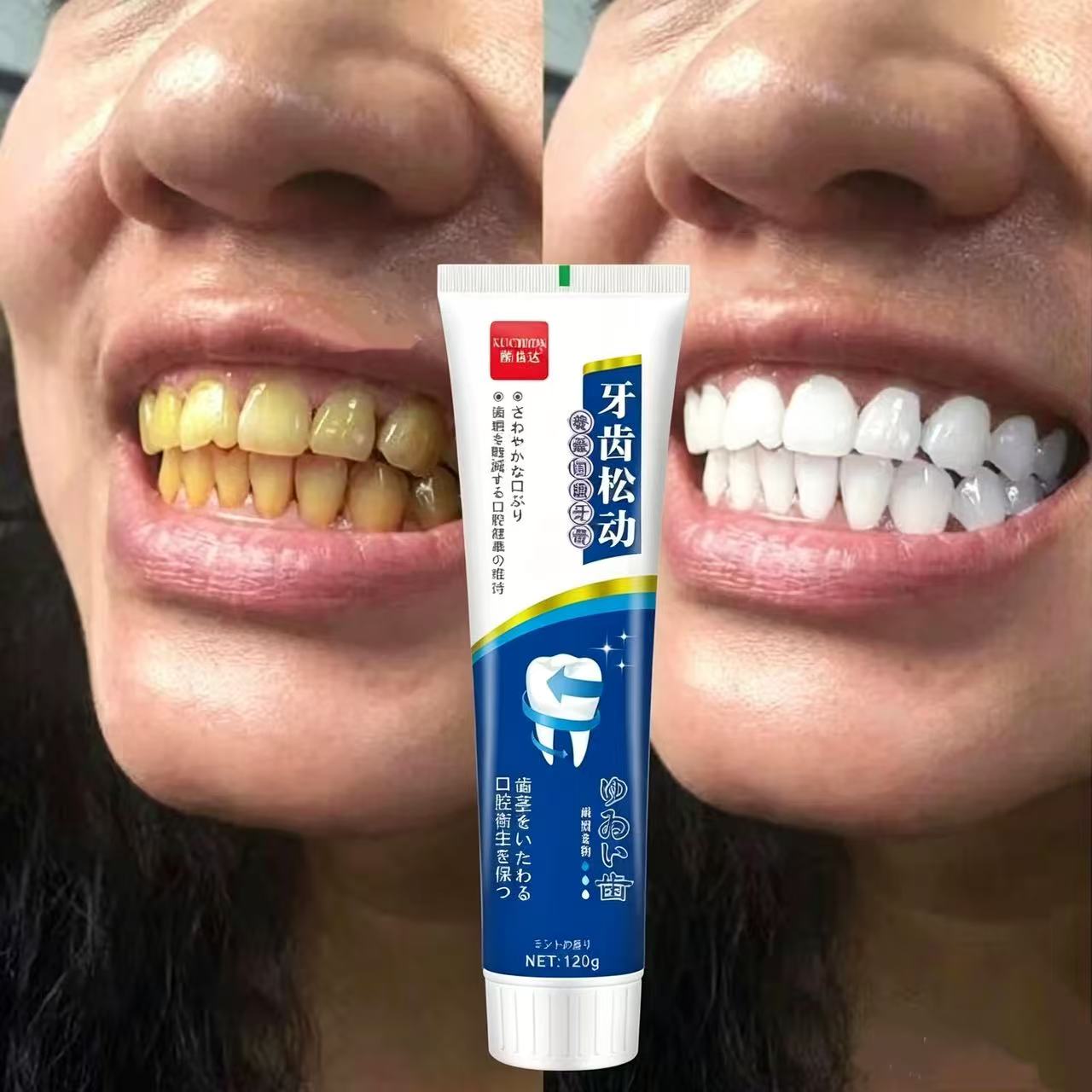 Teeth Whitening Japanese - ยาสีฟันญี่ปุ่นนำเข้าสำหรับฟันหลวม ช่วยดูแลสุขภาพช่องปากตลอดทั้งปี สำหรับผู้ใหญ่ ทั้งชายและหญิง ช่วยให้ฟันขาวขึ้น ดูแลช่องปากให้กระจ่างใส