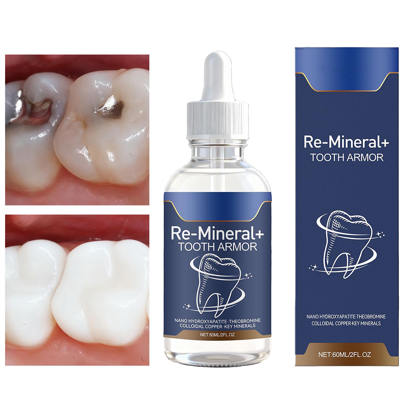 Teeth Whitening Gum - น้ำยาทำความสะอาดฟัน 60 มล. ขจัดคราบฟัน ฟันขาว สำหรับผู้หญิง