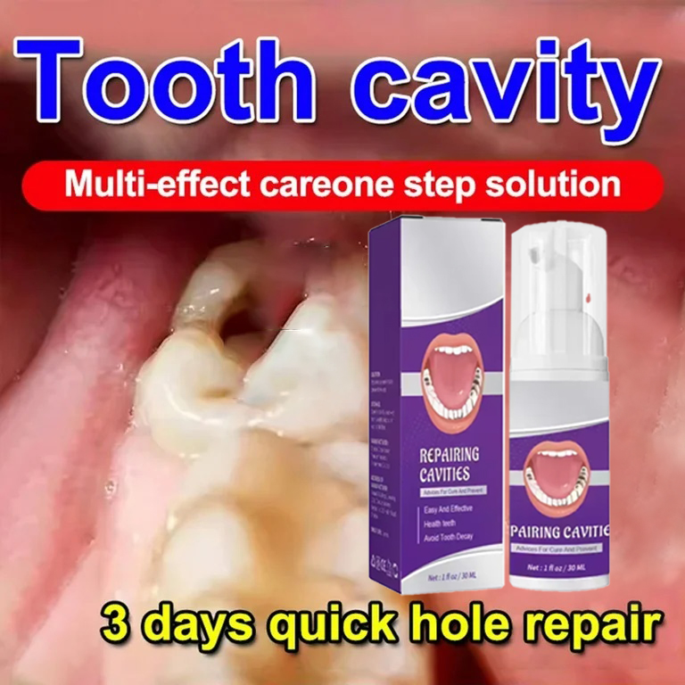 Teeth Whitening Cream - ยาสีฟันทำความสะอาดฟัน ขจัดคราบฟัน ฟันขาวสะอาด ซ่อมแซมฟันผุ ขจัดคราบหินปูน คราบพลัค