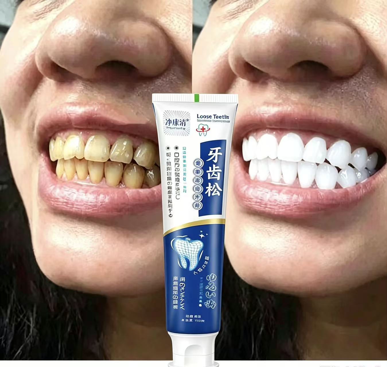 ยาสีฟันญี่ปุ่นนำเข้าสำหรับฟันห - Teeth Whitening Japanese บทวิจารณ์และราคา