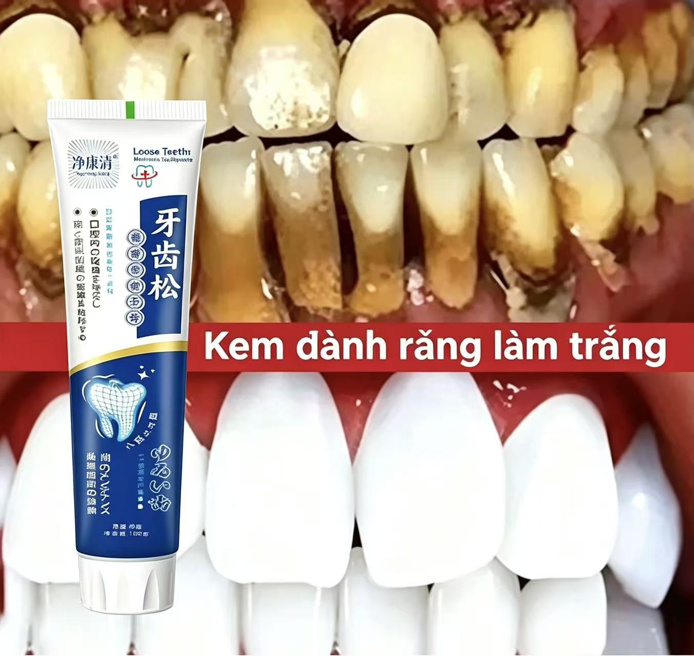 ยาสีฟันญี่ปุ่นนำเข้าสำหรับฟันห - Teeth Whitening Japanese บทวิจารณ์และราคา