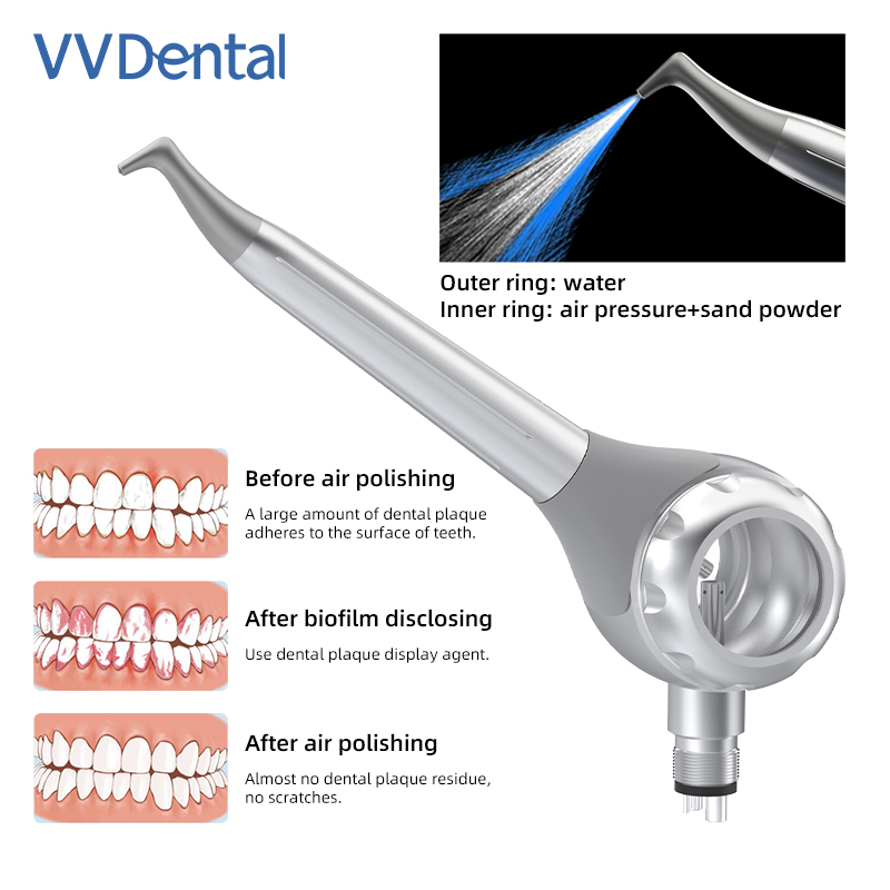 ปืนพ่นทรายฟอกสีฟัน VV Dental 2 - Teeth Whitening Free บทวิจารณ์และราคา