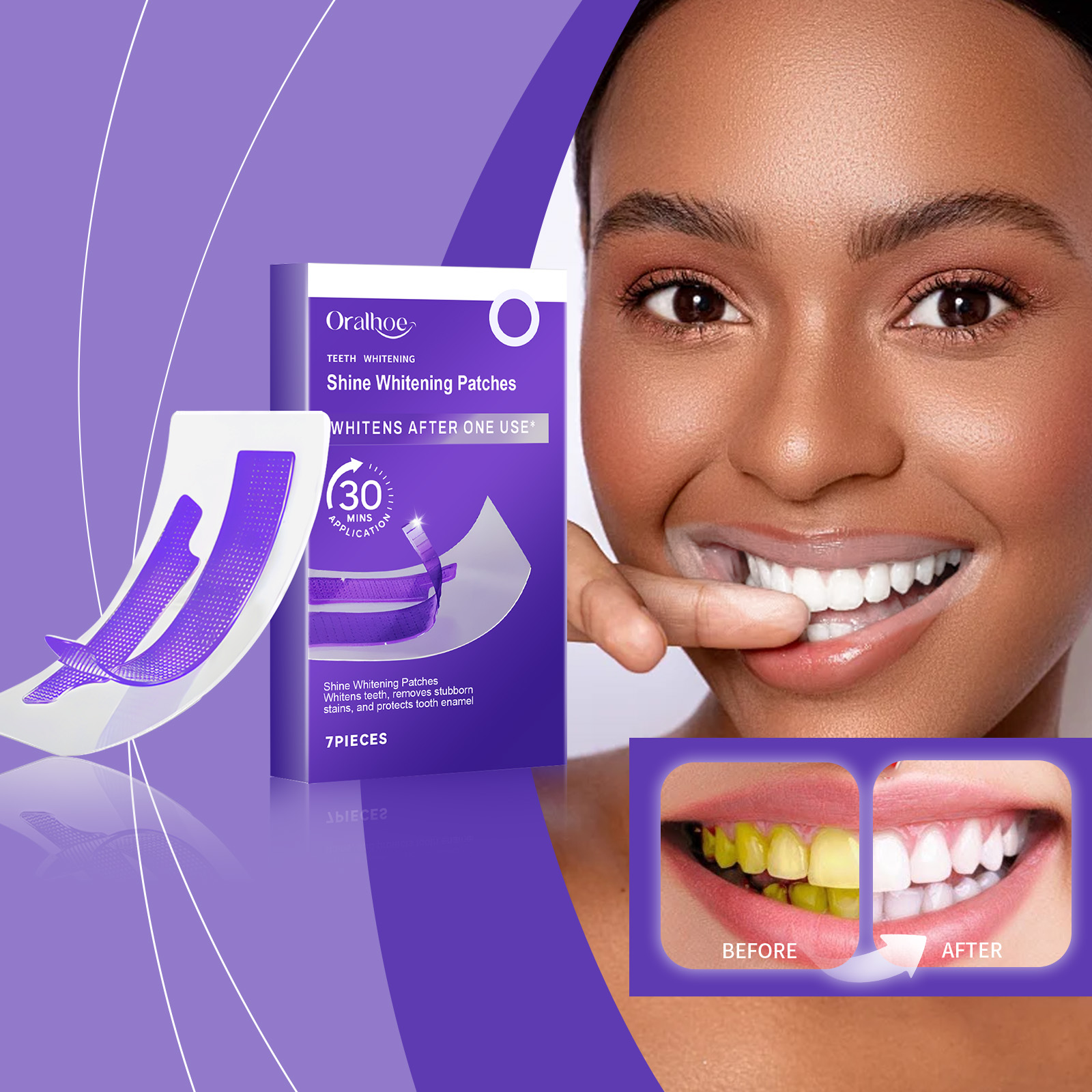แผ่นฟอกสีฟันสีม่วง – ขจัดคราบพ - Teeth Whitening Flash บทวิจารณ์และราคา