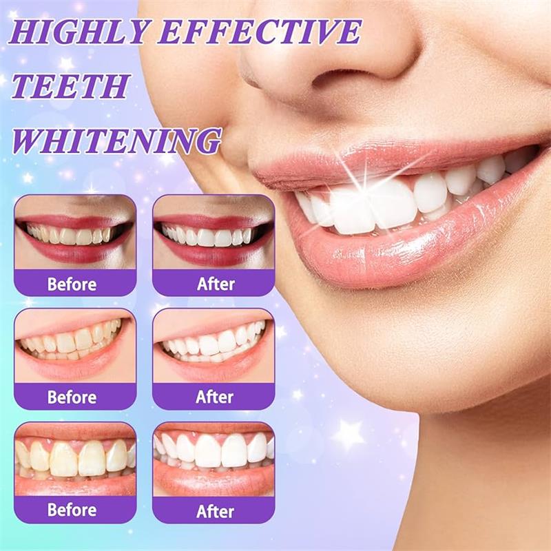 ยาสีฟันมูสฟอกสีฟัน 9D สีม่วง ข - Teeth Whitening Cream บทวิจารณ์และราคา