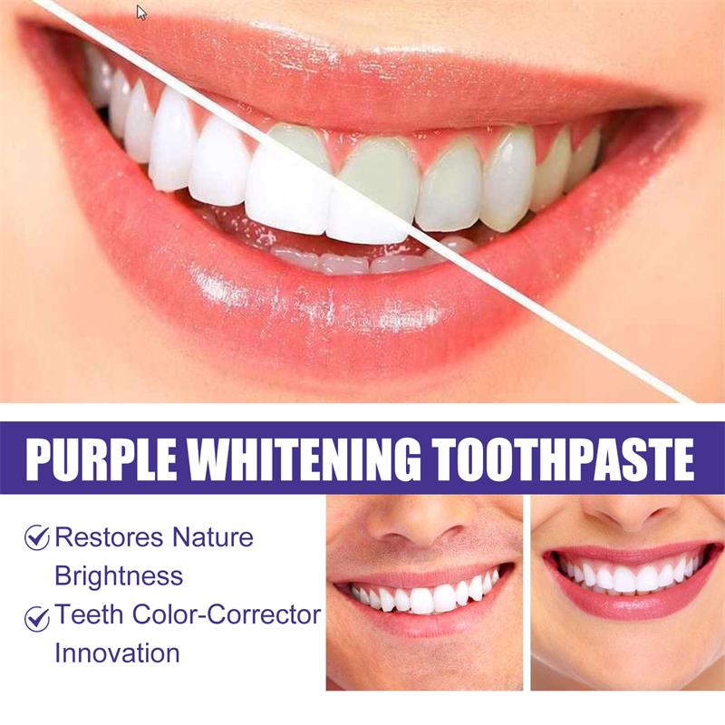 ยาสีฟันมูสฟอกสีฟัน 9D สีม่วง ข - Teeth Whitening Cream บทวิจารณ์และราคา