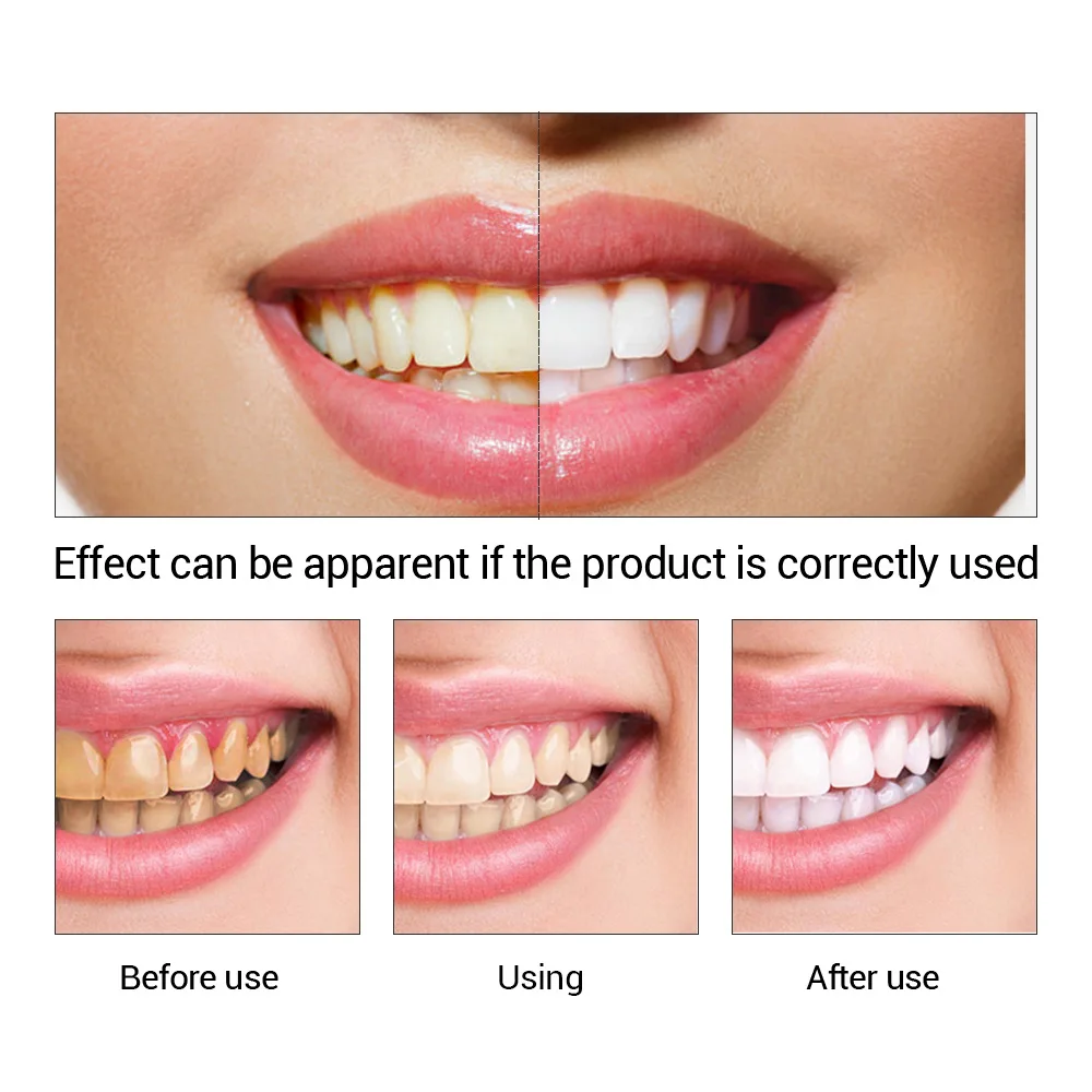 FTEENPLY ฟันไวท์เทนนิ่ง Oral ส - Teeth Whitening Flash บทวิจารณ์และราคา