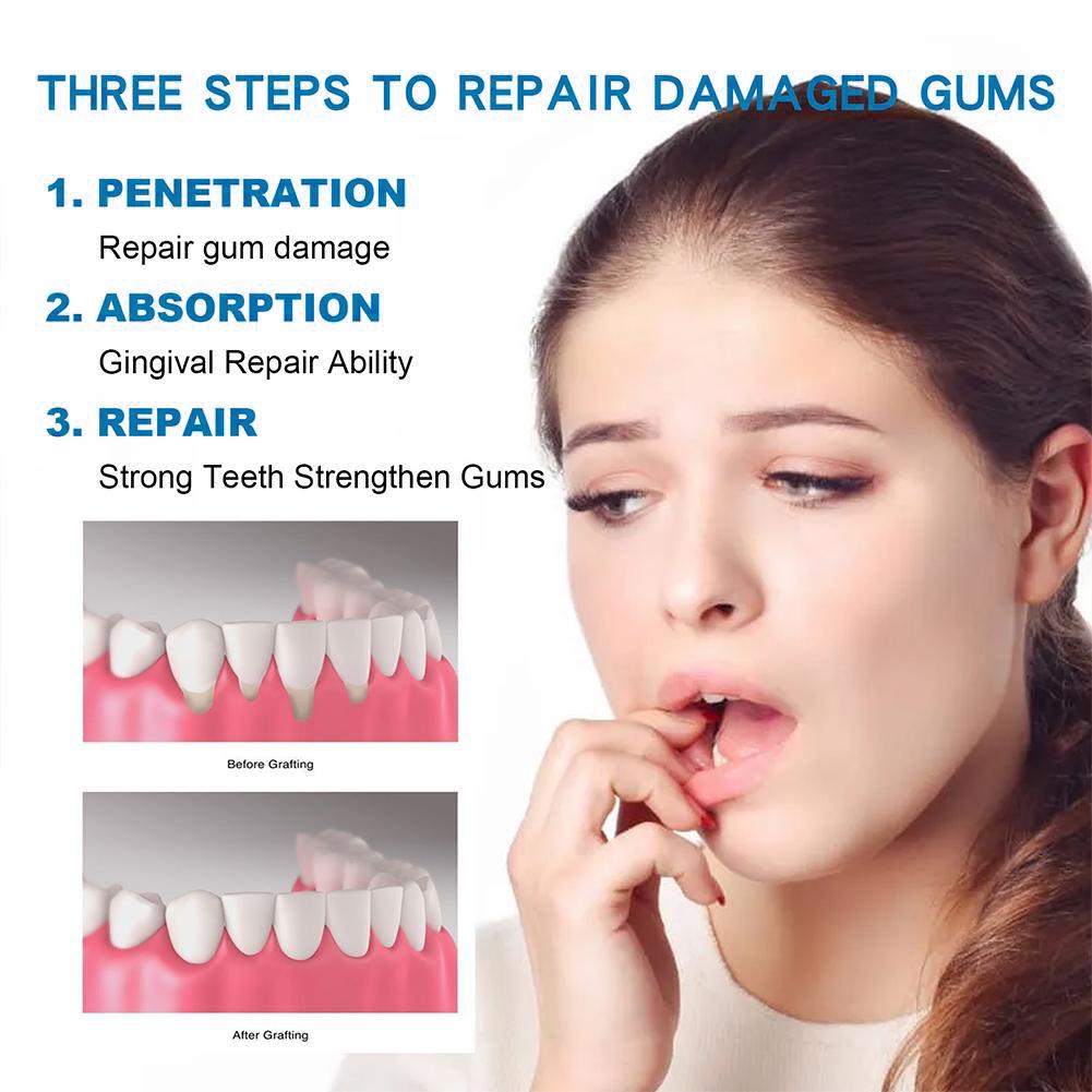 ยาสีฟันดูแลสุขภาพช่องปาก ยาสีฟ - Teeth Whitening Cream บทวิจารณ์และราคา