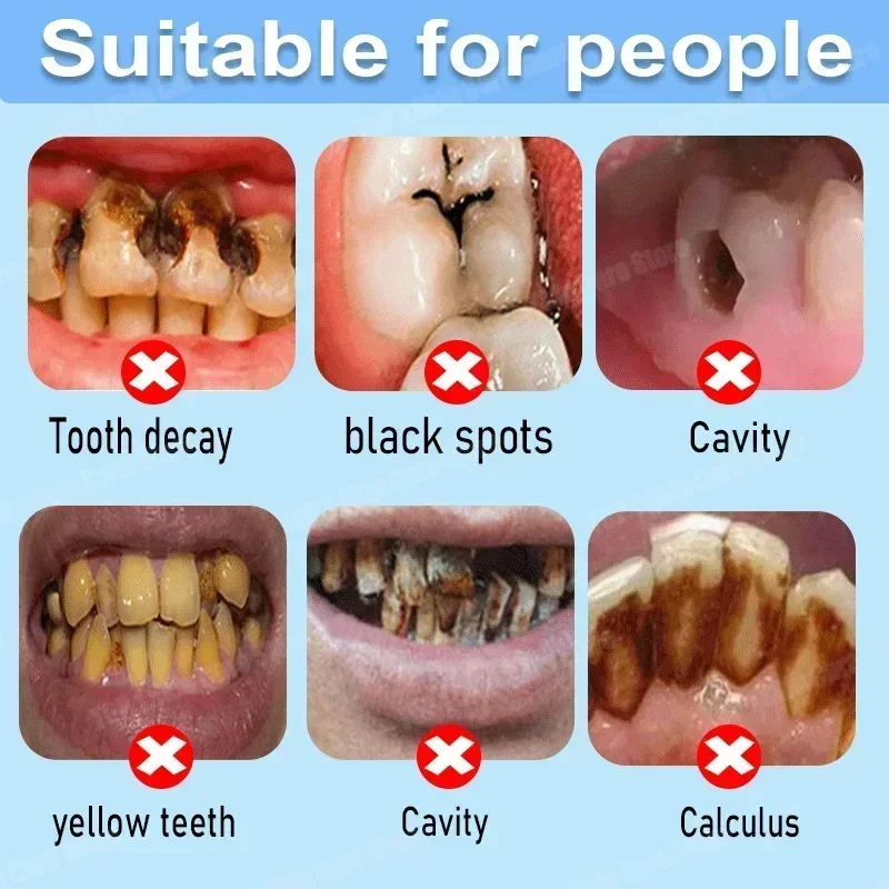 ยาสีฟันป้องกันฟันผุ ซ่อมแซมฟัน - Teeth Whitening Uv บทวิจารณ์และราคา