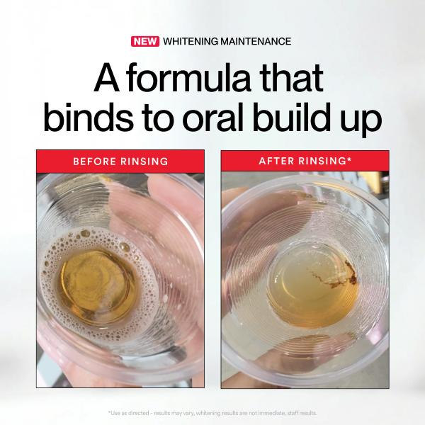 ฮิสไมล์ ไอดี ไวท์เทนนิ่ง สเตน  - Teeth Whitening Products บทวิจารณ์และราคา