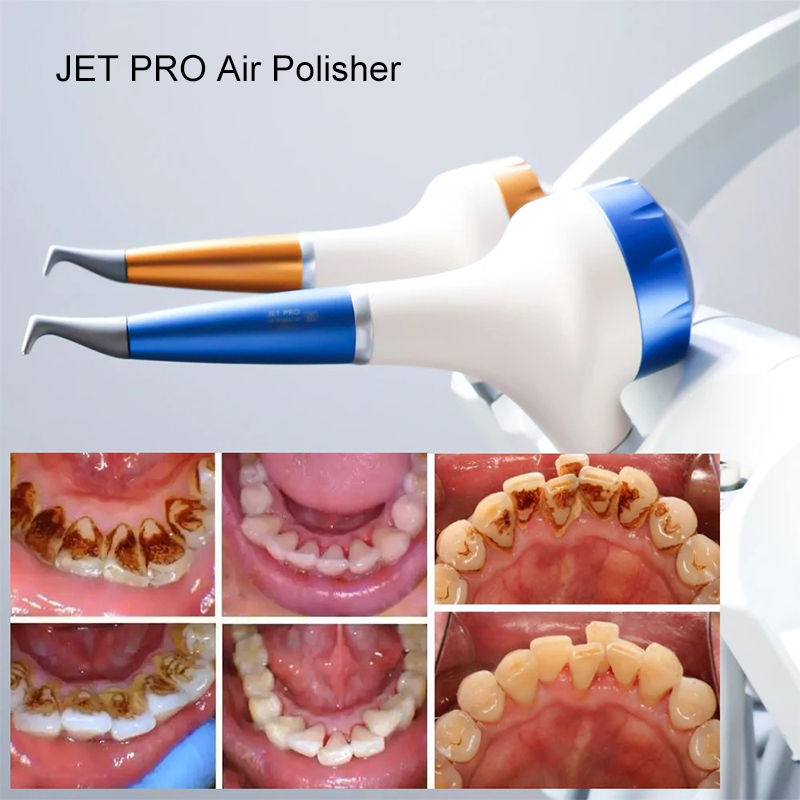 เครื่องขัดฟันด้วยลม VV Dental  - Teeth Whitening Free บทวิจารณ์และราคา