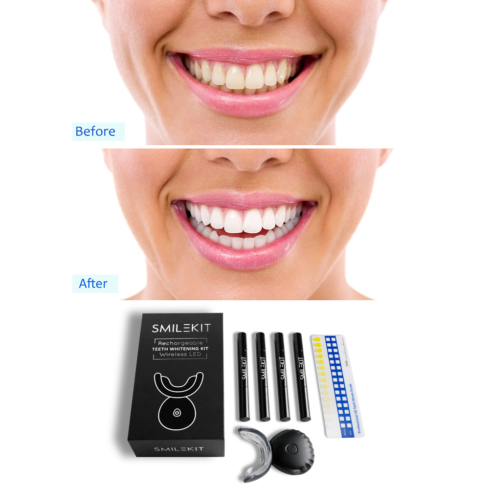 ใหม่ไฟฟ้าฟอกสีฟัน LED บ้านไร้ส - Teeth Whitening Uv บทวิจารณ์และราคา