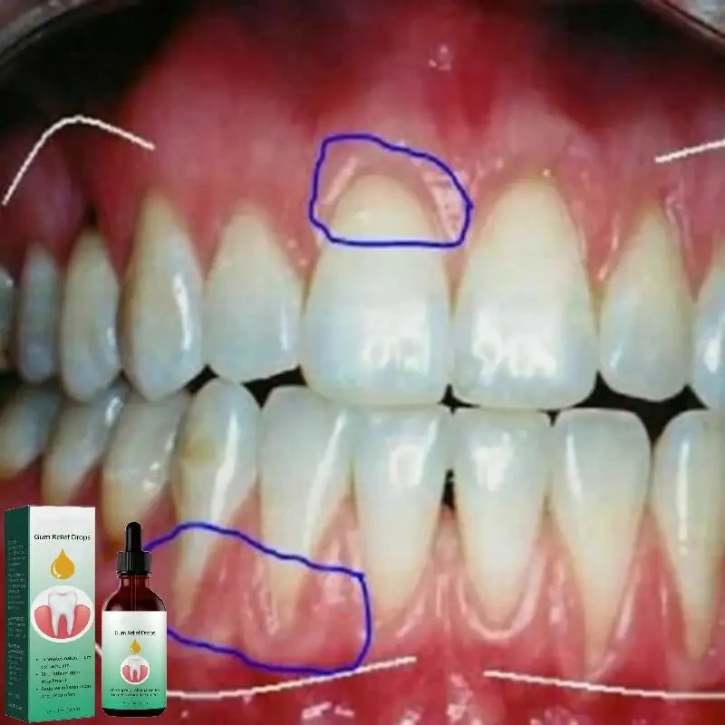 Gum Repair หยดบรรเทาถอนเหงือกบ - Teeth Whitening Paste บทวิจารณ์และราคา