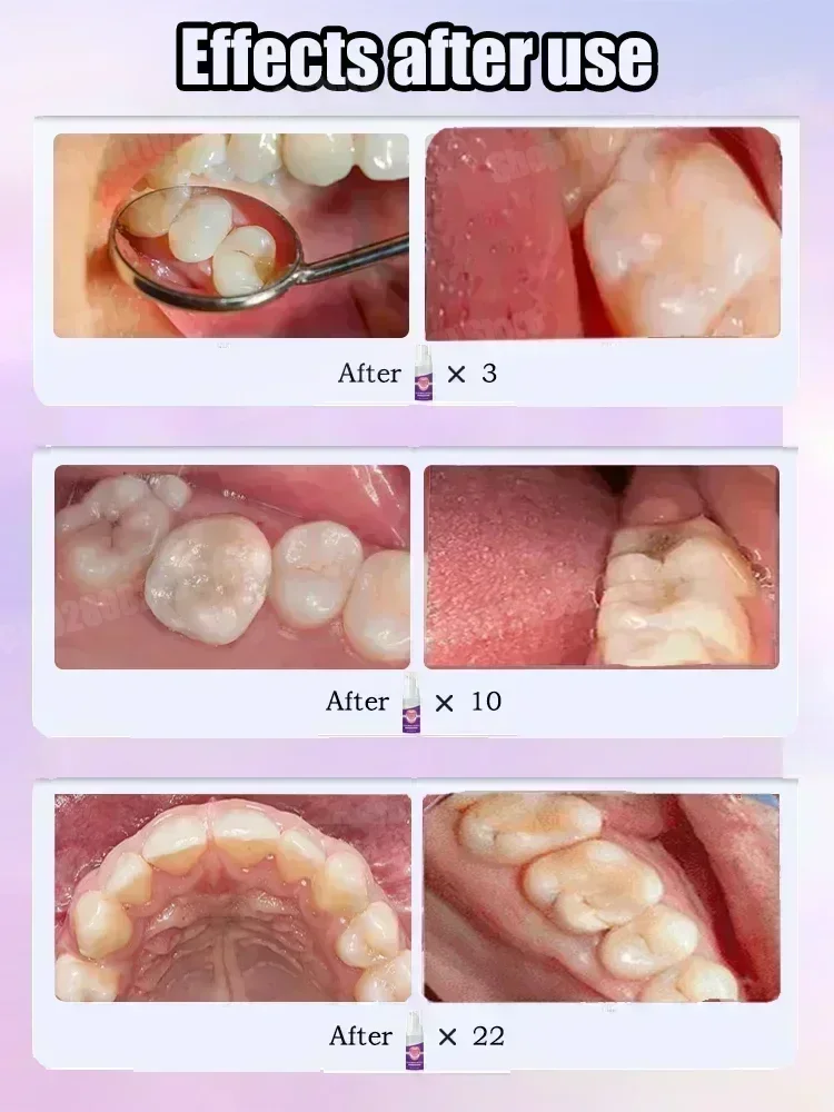 ยาสีฟันทำความสะอาดฟัน ขจัดคราบ - Teeth Whitening Cream บทวิจารณ์และราคา
