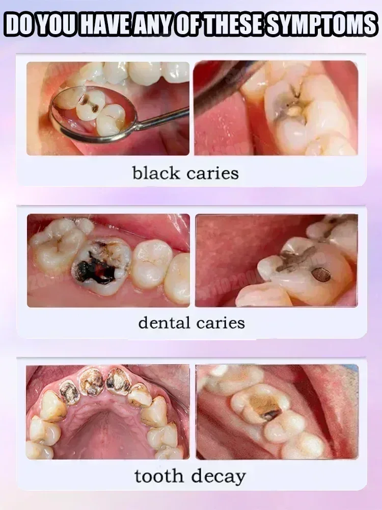 ยาสีฟันทำความสะอาดฟัน ขจัดคราบ - Teeth Whitening Cream บทวิจารณ์และราคา