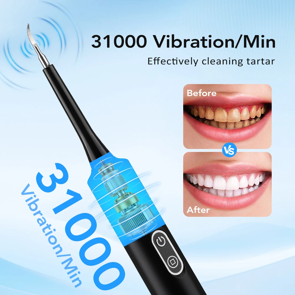 เครื่องขจัดคราบหินปูนไฟฟ้าแบบส - Teeth Whitening Products บทวิจารณ์และราคา